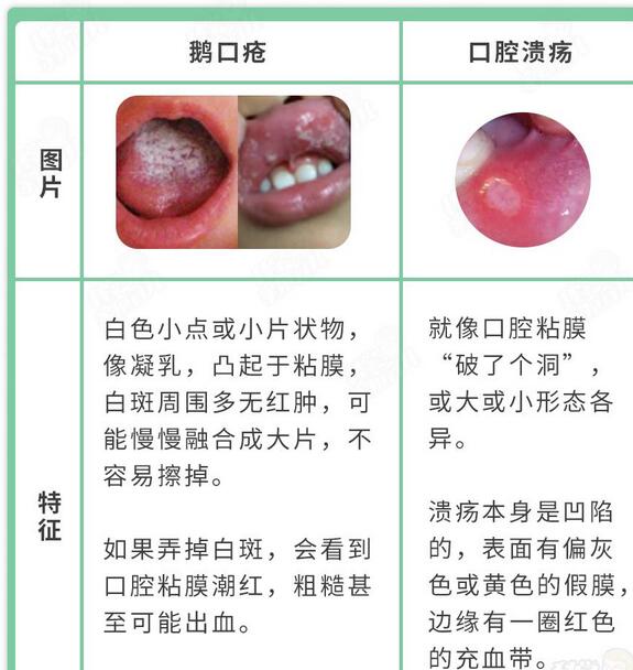 3(g)(x)TTl(f)Zگٲ